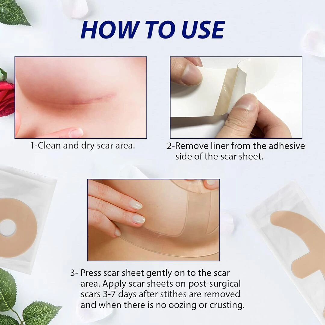 Breast silicone scar sheets..