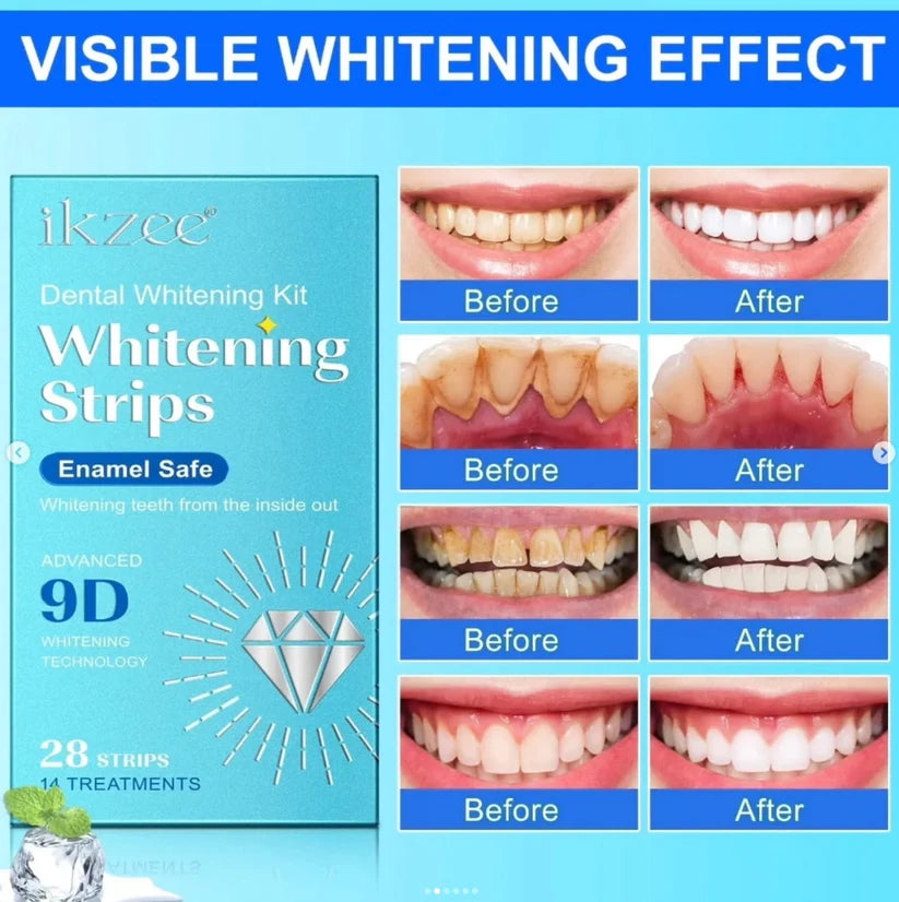 Teeth Whitening Strips – Safe, Effective ; Non-Sensitive Formula