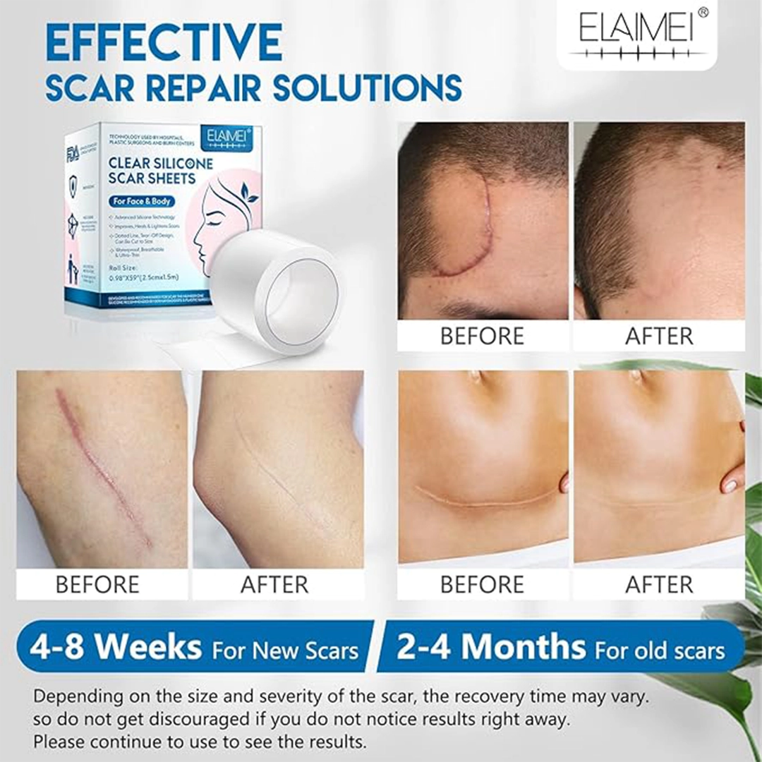 Clear Silicone Scar Sheets