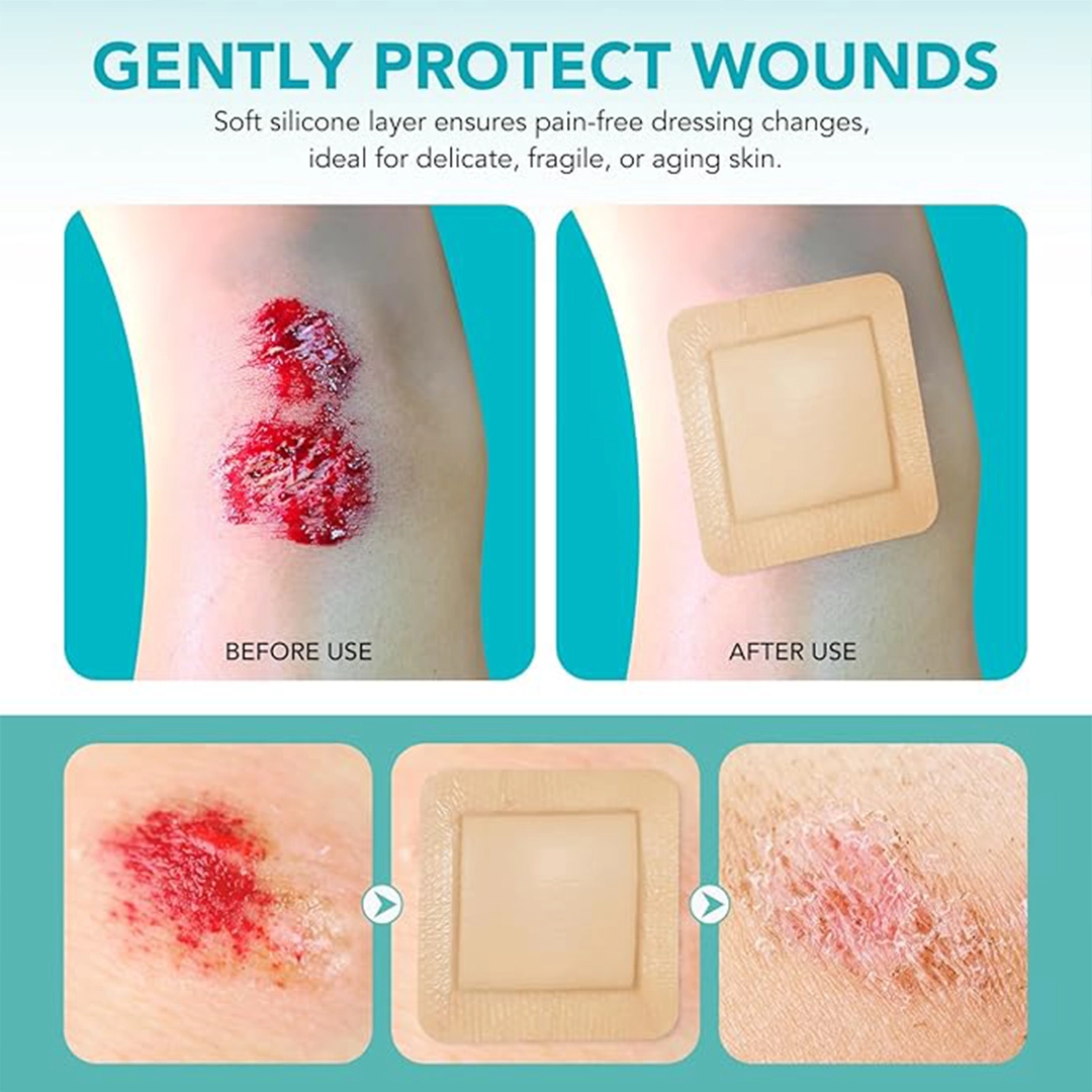 Silicone Foam Dressing With Silver AG+