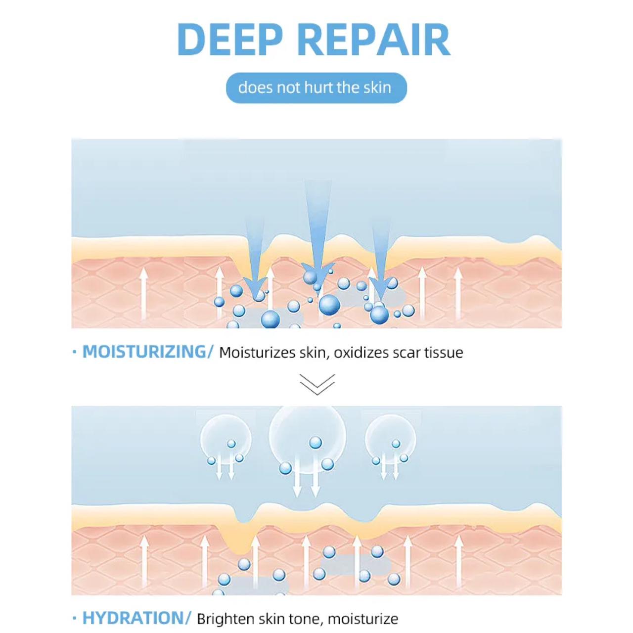 Silicone Scar Sheets