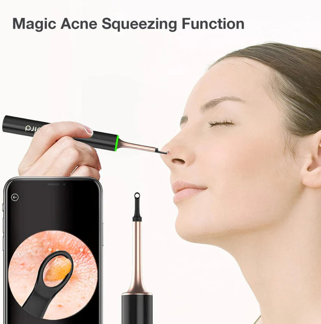 Woman using a device with a smartphone showing an inset of skin issues, labeled 'Magic Acne Squeezing Function'.