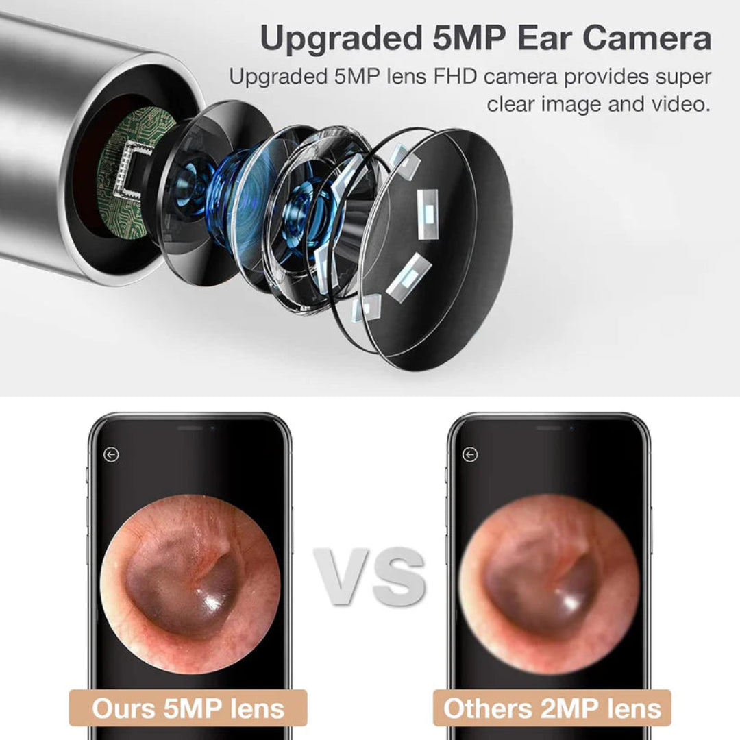 Upgraded 5MP ear camera with detailed lens components and comparison of image quality on smartphones.