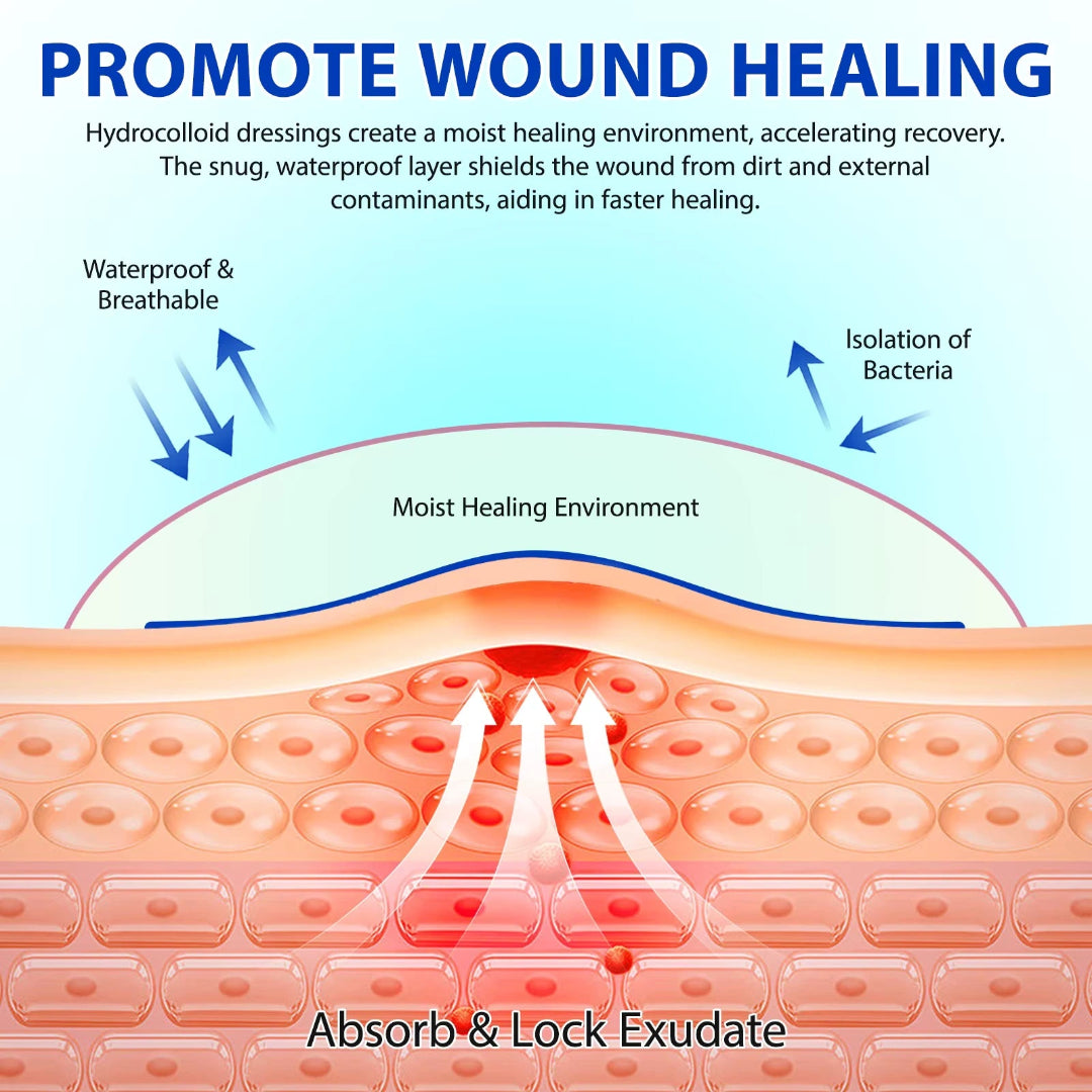 Diagram of hydrocolloid dressing promoting wound healing with text explaining its benefits.
