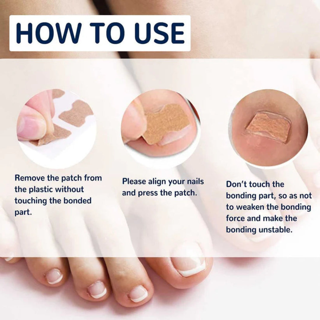 Instructions on how to use a nail bonding patch with close-up shots of toes and patches.