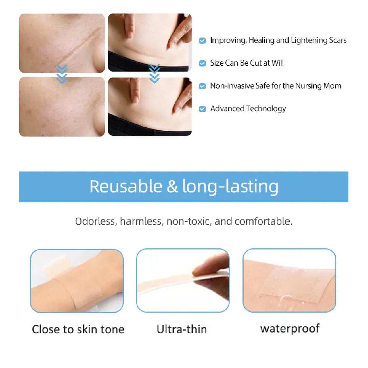 Silicone Scar Sheets